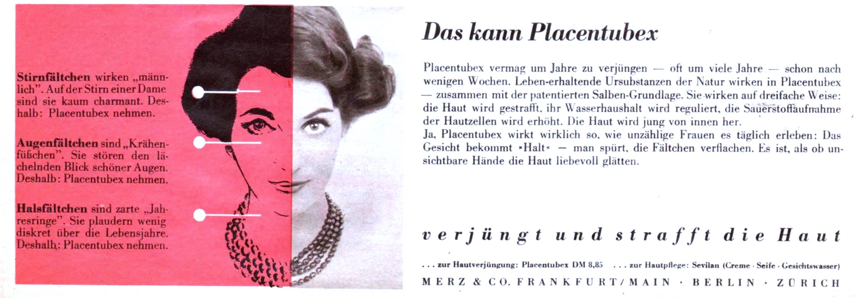 Plazentubex 1960 70.jpg